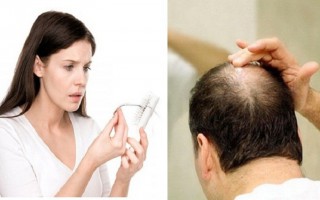 Duy trì phong độ nhờ bí kiếp An Calvitie: chống rụng chữa hói tóc
